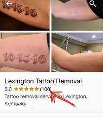 However, it is very important to know that over 100 tattoo inks are in use worldwide today, none of which are regulated by the fda. Lexington Tattoo Removal Posts Facebook
