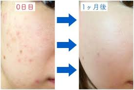 記事番号 576 アイテムid 51523の画像 ニベア スキンケア 平子理沙