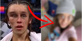 Jedrzejczyk started things off with a post of a. Joanna Jedrzejczyk Shows Transformation After Brutal Ufc 248 Hematoma