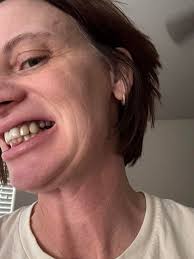 Hi, me again with the 81 year old mother with pain after surgery. Her pain  decreased with 2 oxycodone pills. But she refuses to take it again because  of stomach pain. She