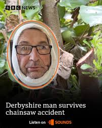 Christopher, from Chesterfield, survived "catastrophic blood loss" after  accidentally cutting his neck open with a chainsaw 😮 Listen to his  interview here: https://bbc.in/4nsBrLe