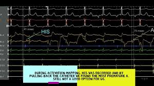 Ορθοπεδικοσ χειρουργοσ νεα μακρη αττικη χατζηχρηστου μαριοσ. A Kardiologikh Klinikh Ery8ros Stayros 1st Card Dep Red Cross Hospital Posts Facebook