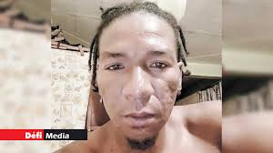 Il décède après 12 jours d'hospitalisation : Jean Alain Baptiste laisse  derrière lui 7 enfants