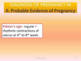 In medicine, goodell sign is an indication of pregnancy. Lecturer Forensic Medicine Mcst Ppt Download