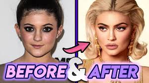 31.05.2018 · to this day, kim kardashian hasn't fessed up to any plastic surgery. Kris Jenner Before And After Transformations Plastic Surgery Rumours Youtube