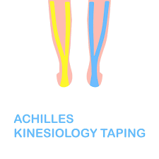 This concavity slackens the medial fibers, preventing excessive tension on these fibers during daily activity and allowing healing to occur. Foot And Ankle Problems By Dr Richard Blake Achilles Tendon Taping With Leukotape And Coverlet