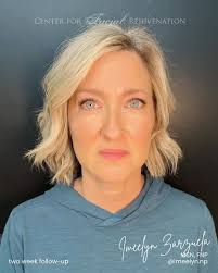 Center for Facial Rejuvenation