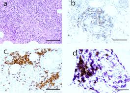 The medial and lateral edges of border are hydrophilic while the. Dynamic Changes In Cellular Infiltrates With Repeated Cutaneous Vaccination A Histologic And Immunophenotypic Analysis Springerlink