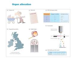 Organ Allocation There Are Many More People On The Transplant Waiting List Than There Are Organs Available T Kidney Transplant Lung Transplant Liver Failure