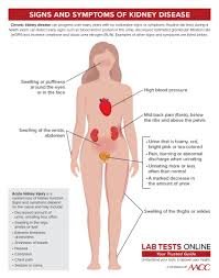 Plk Lancet Kenya On Twitter A Kidney Stone Risk Panel Is A Test Used To Help Evaluate The Likelihood That An Individual Who Has Had Kidney Stones Will Develop Additional Ones Indicating