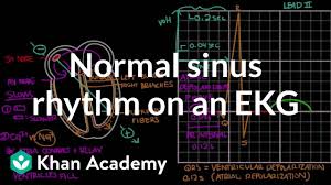 12 lead normal sinus rhythm ekg. Normal Sinus Rhythm On An Ekg Circulatory System And Disease Nclex Rn Khan Academy Youtube