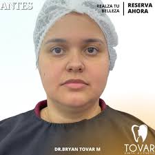 TovarDent (@tovardental_esthetic) · Quevedo