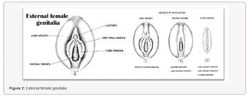 Test empirico di funzionamento del sensore. The Challenge Of Female Genital Mutilation Iris Publishers