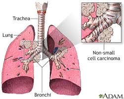 Pin On Pathophysiology