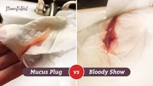 When you lose your mucus plug, also known as having a 'show' (or a 'bloody show' how long after losing your mucus plug do you go into labour? Mucus Plug Does Labor Start When You Lose It Photos