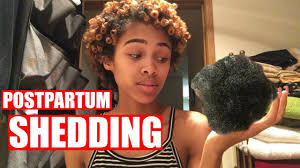 What's the best type of exercise to start with? Postpartum Shedding How To Stop Your Hair From Shedding Falling Out After Giving Birth Youtube