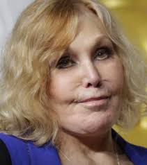 Difficile capire chi è, vero? In passato è stata una delle attrici più  belle e famose. Poi la chirurgia e il botox l'hanno resa così  (irriconoscibile): https://is.gd/gqILdH