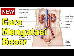 Check spelling or type a new query. Cara Mengatasi Beser Pada Pria Maupun Wanita Youtube