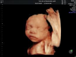 The 4D Ultrasound Lady added a...