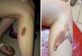 Back Birthmark Cover Up Tattoo Pin On Love