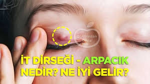 Halk Arasinda It Dirsegi Ve Arpacik Adi Verilen Goz Cevresinde Beliren Kabarti Nedir Ne Iyi Gelir Nasil Tedavi Edilir Konusunda E Sleep Eye Mask Eyes Person