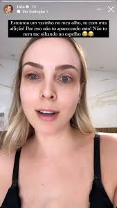 Tata Estaniecki mostra imprevisto no olho após estourar veia