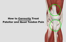 Discusses common achilles tendon problems. Fixing Patellar Quad Tendon Pain Squat University