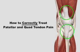 The main reasons for leg pain. Fixing Patellar Quad Tendon Pain Squat University