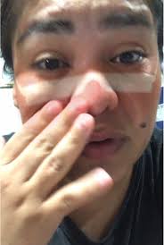 MIREN COMO TENGO MI CARA😭😰🥺#megolpee #lastimadura #hazmeviral #para...