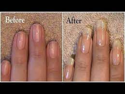 Gradually, a healthy nail will grow in. Pin On Ongles