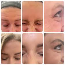 Injections By Jordan