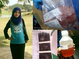 Tanda tanda cewe mau orgasme, umumnya otot perut bagian bawah menegang / berkontraksi seperti orang ngeden kesulitan ngeluarin tokai. Perut Buncit Macam Wanita Mengandung Kedua Dua Ovari Rahim Dibuang Berpunca Ketulan Cyst Merbahaya Mingguan Wanita