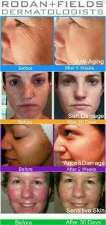 Beautiful Skin by Britt