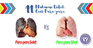 Gangguan kesehatan ini terbilang umum di indonesia, dan termasuk jenis penyakit yang tidak menular. 11 Makanan Untuk Cuci Paru Paru Supaya Bebas Dari Toksin Dan Penyakit