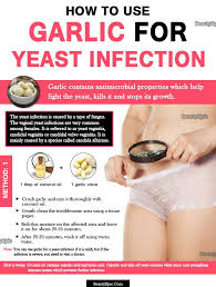 How To Treat Yeast Infection With Garlic Treat Yeast Infection Garlic For Yeast Infection Yeast Infection Treatment