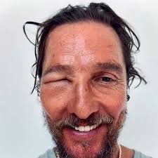 Obľúbeného herca na FOTO nespoznáte: Čo to má, preboha, s tvárou? Veď  vyzerá ako Shrek!