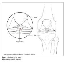 A new study in the 'new england journal of medicine' finds that one after one year, the doctors saw no measurable difference in how well the two groups' knees healed. Pain Management After Acl Surgery