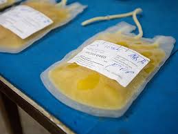 Image result for Platelet Transfusion