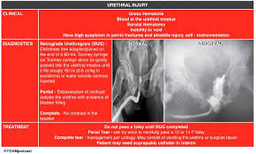 Image result for Retrograde Urethrogram