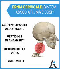 Gentile dottore le scrivo qui il referto. Ernia Cervicale 3 Sintomi Da Conoscere Assolutamente Tutti Gli Altri