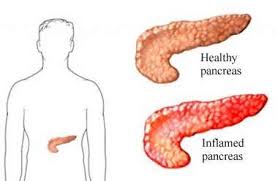 Image result for pancreas)