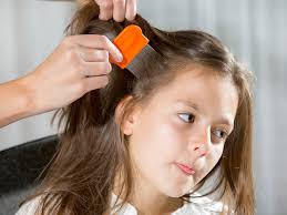 Head Lice 101. By Our August Student Pharmacist, Mackenzie Gill.