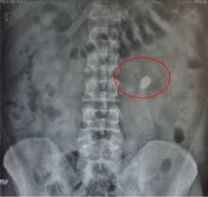 Pin By Kathy I On Radiology Radiography Radiology Medical