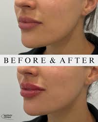 The Aesthetic Clinique