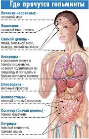 как избавиться от глистов у человека в домашних условиях Antiparazitarnoe Ochishenie Lichnyj Opyt Health Fitness Medical Anatomy Health