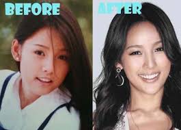 Lee Hyori Plastic Surgery Before And After Photos Bad Celebrity Plastic Surgery Lee Hyori Plastic Surgery