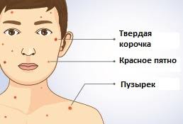 Расшифровка симптомов