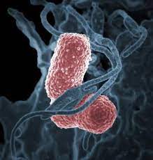 Pan Resistant Cre Reported In Nevada Cidrap