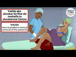 Yadda Ake Aiwatar Da Fitar Da Mahaifa Ta Aiwatarwar Hannu Youtube