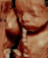 Check spelling or type a new query. 24 Weeks 3d 4d Hd Live Ultrasound